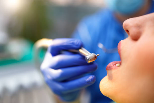 Dental Bonding in Hueytown, AL